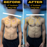 Personalized 4-Week Scoliosis Training Plan