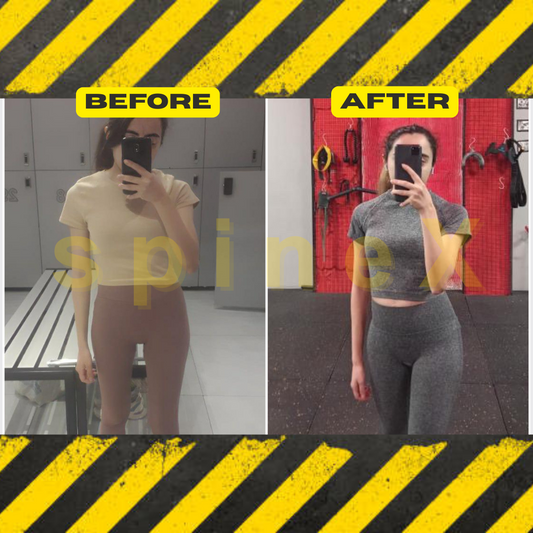 unilateral training for scoliosis correction