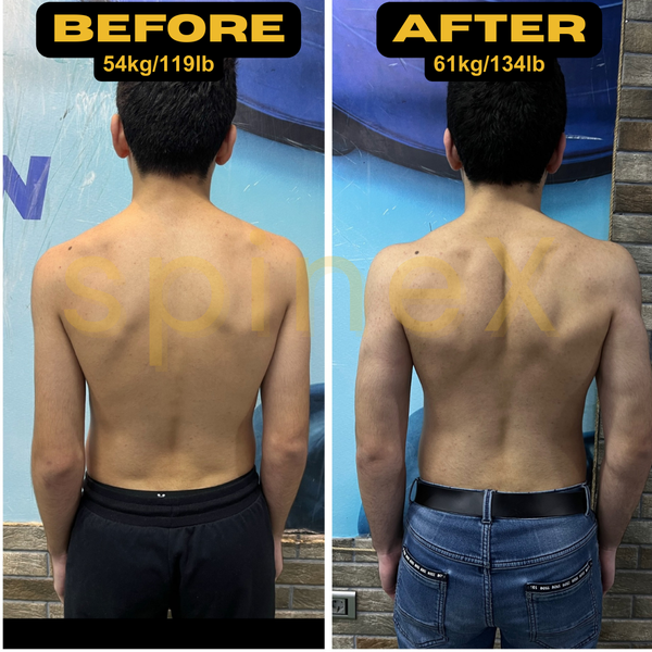 12-Session Scoliosis Fitness Plan + 4-Week Personalized Diet (Fully Customized for Your Spine)