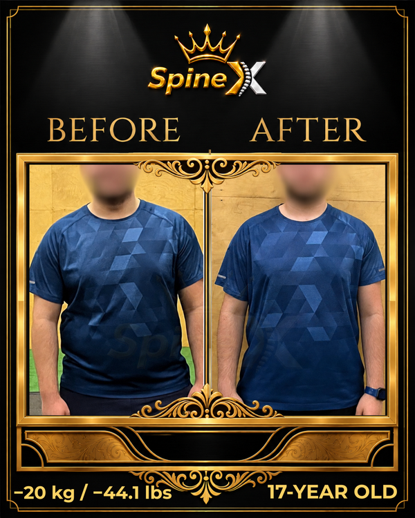 Online Scoliosis Transformation with 17-year old transformation