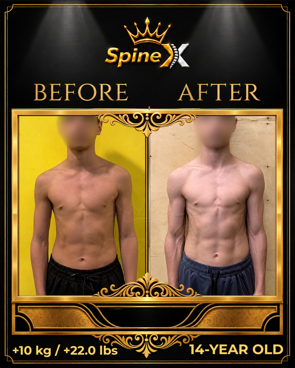 Online Scoliosis Transformation with 14-year old transformation