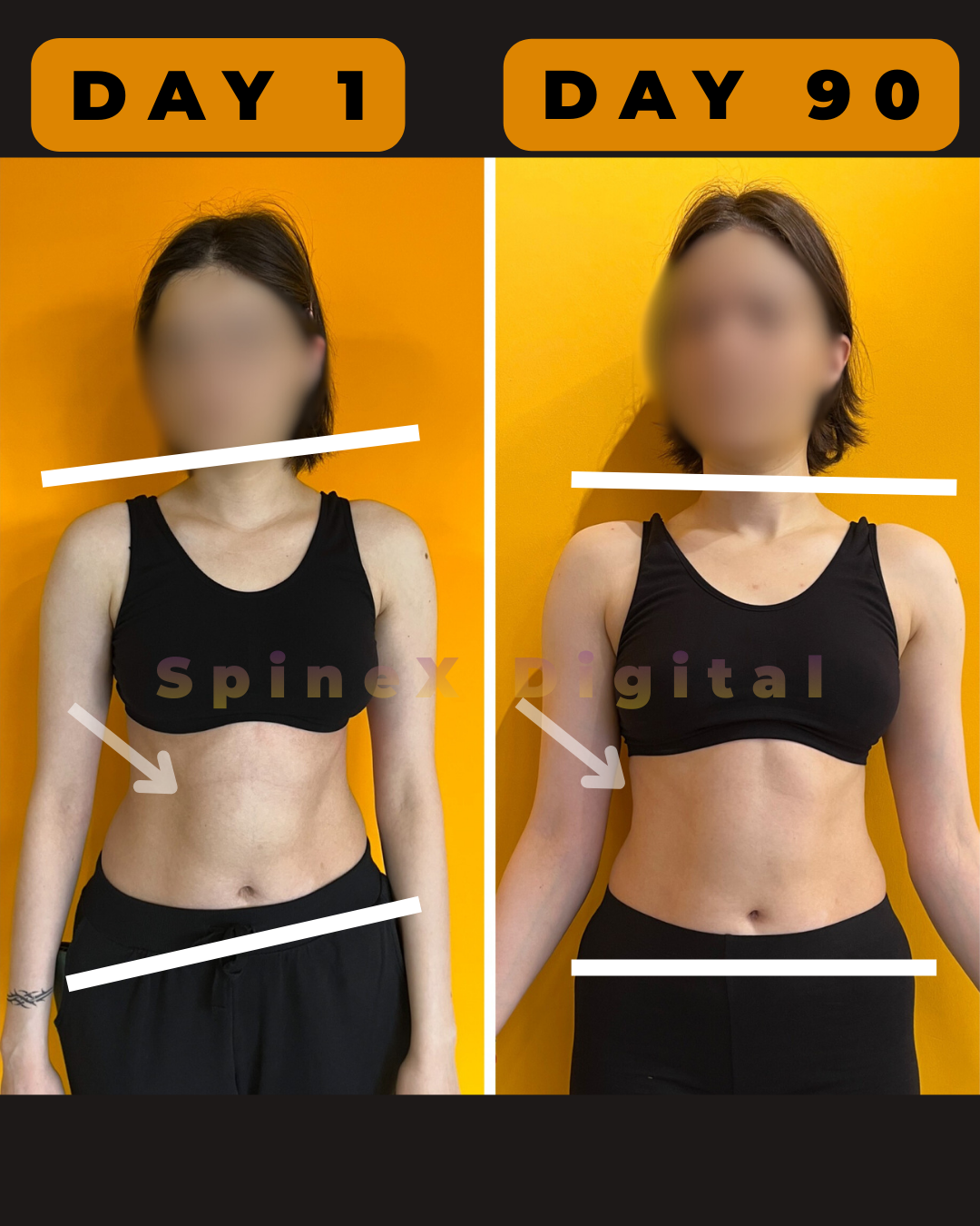 before and after scoliosis posture transformation day 1 to day 90 showing improved body symmetry shoulder alignment waist balance and spinal posture correction