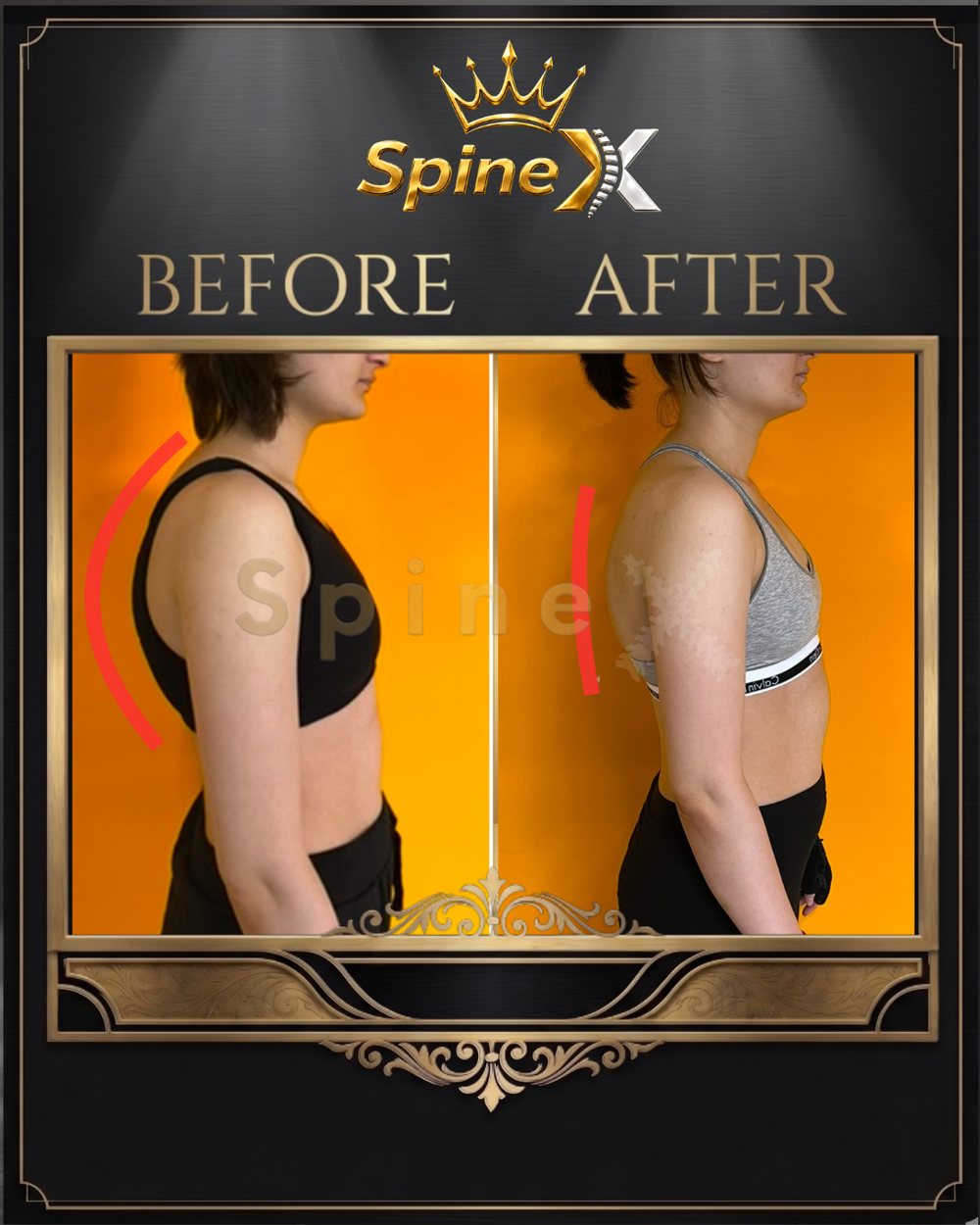Before-and-after posture photos of an individual SpineX coaching client
