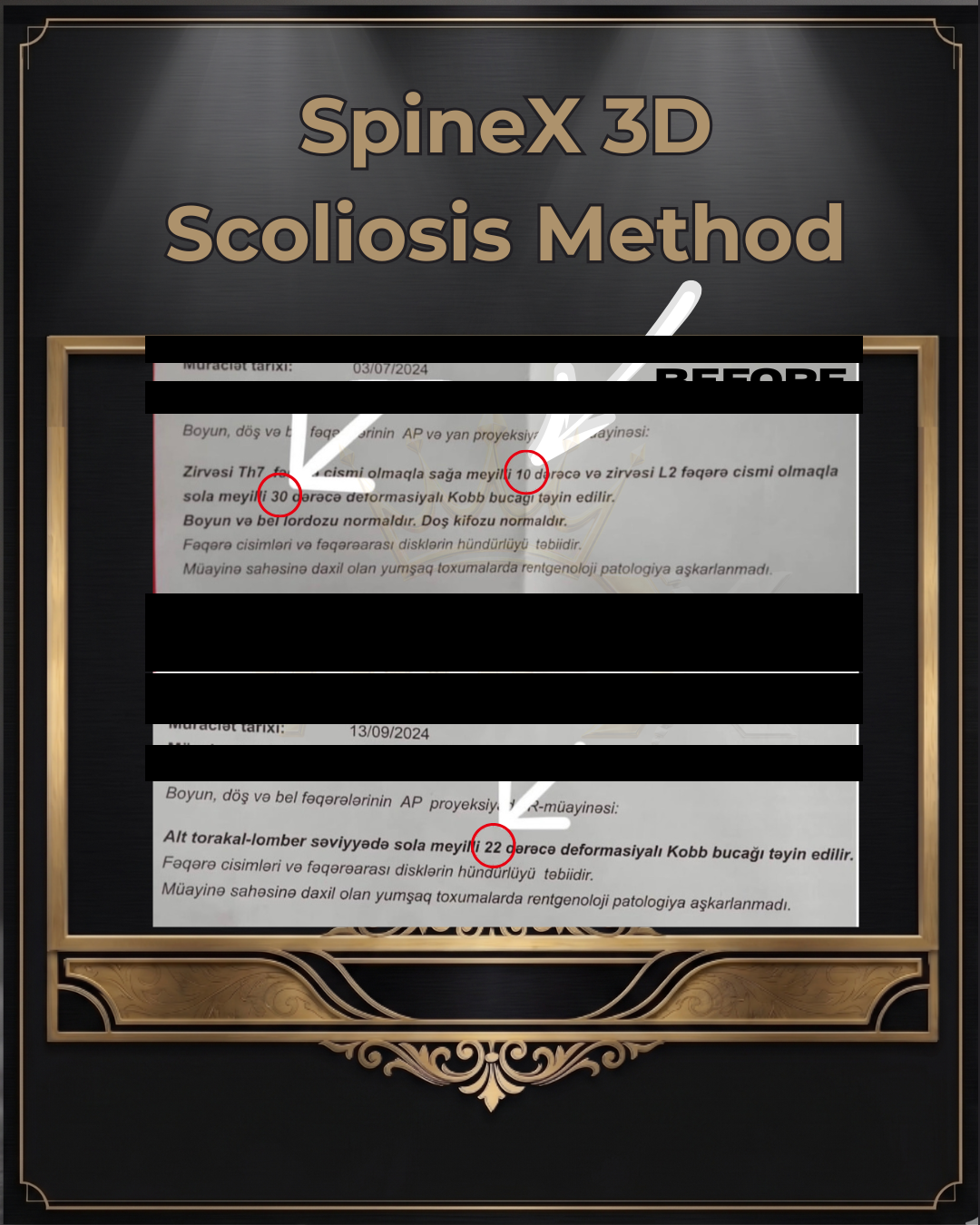 Supporting radiology reports · lower curve comparison