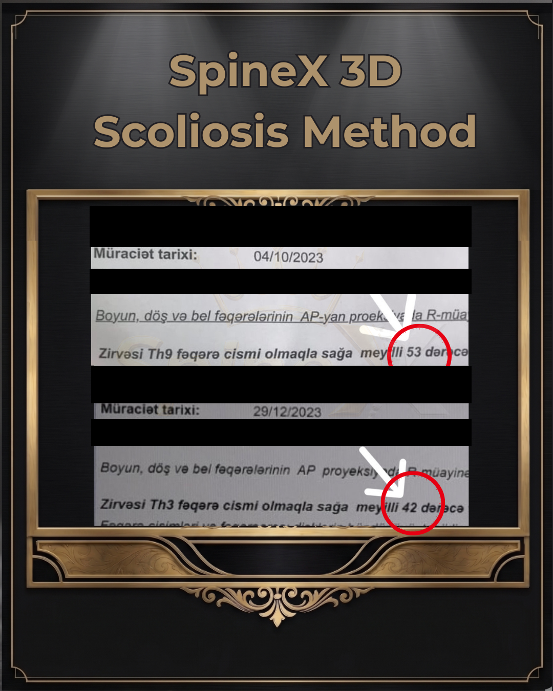 Supporting radiology reports · 53° and 42°
